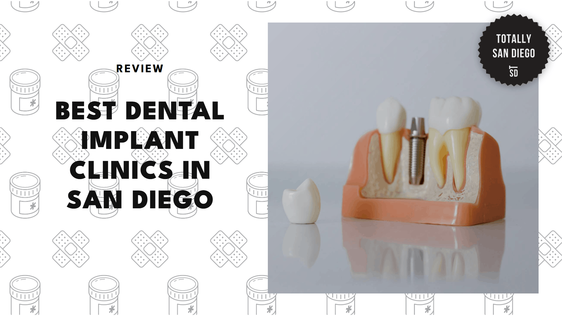 dental-implant-san-diego-banner