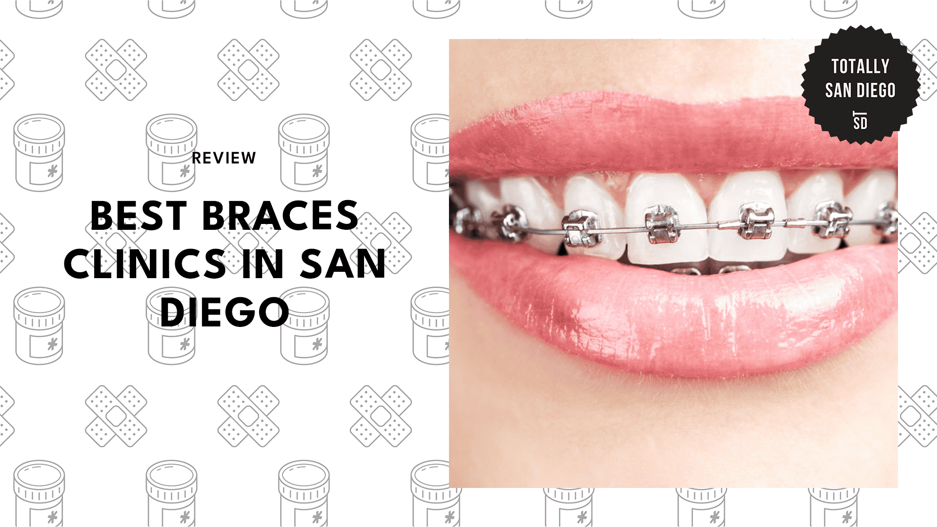 best-braces-san-diego