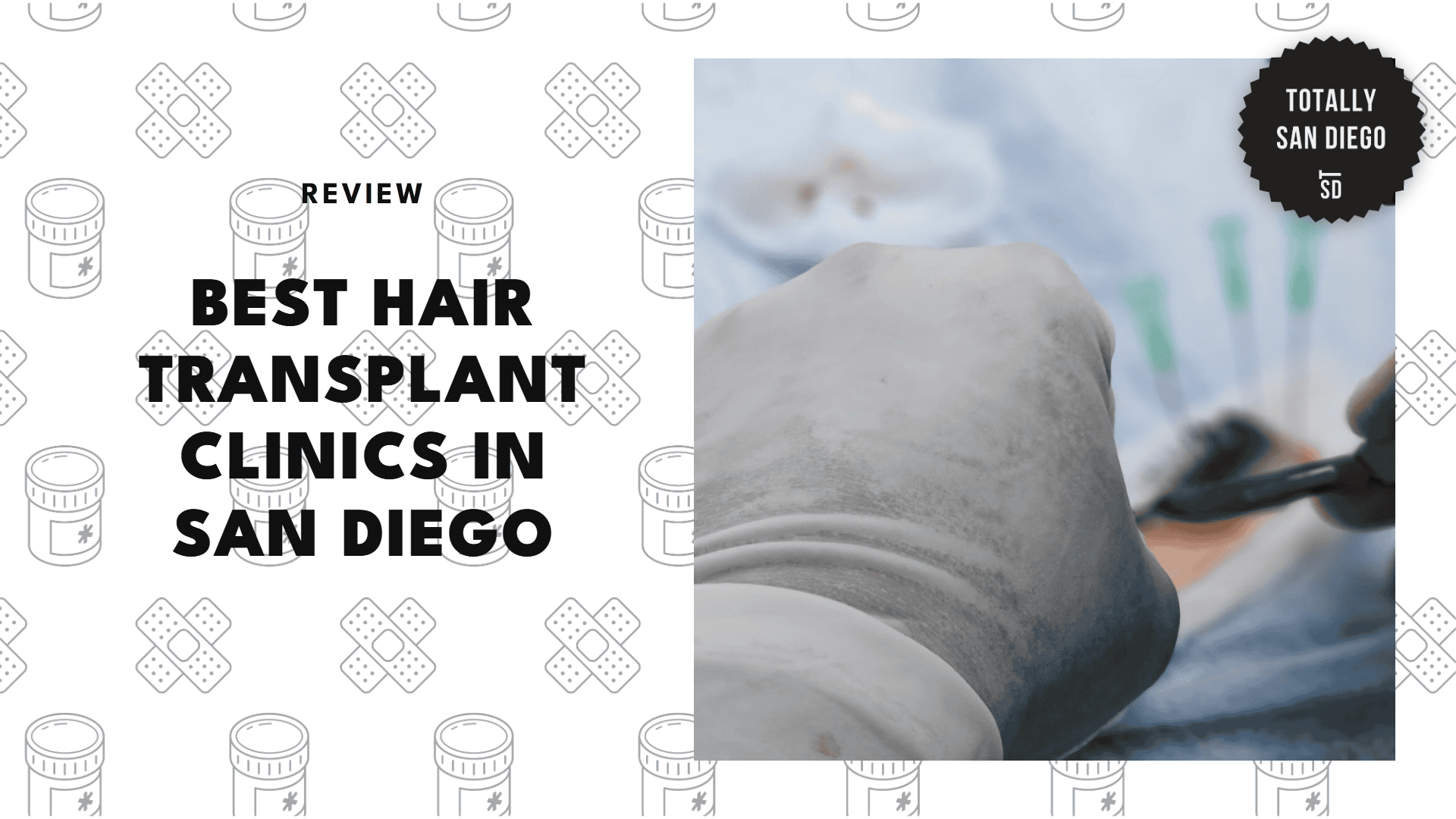 hair-transplant-in-san-diego