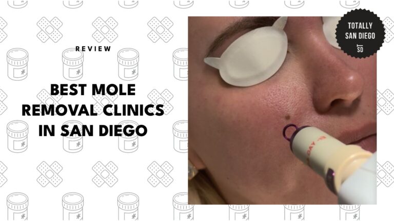 best-mole-removal-san-diego-banner