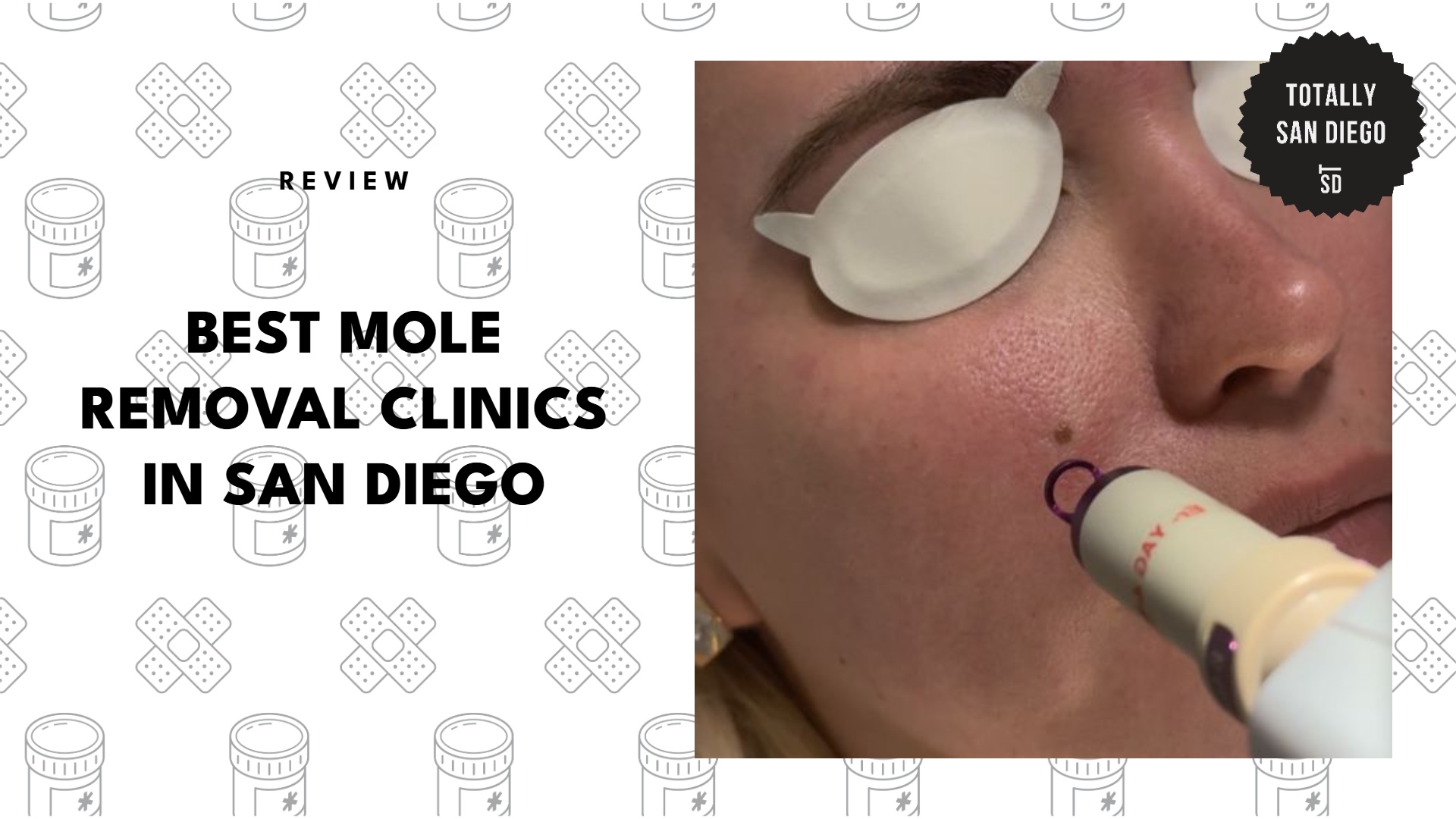 best-mole-removal-san-diego-banner
